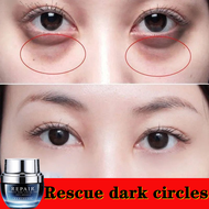 Anti Aging Eye Cream for Dark Circles