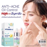 AR Vitamin E ANTI-Acne &amp; Oil Contorl Booster Serum 10ml