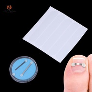 { MY Fashion }   Ingrown Toenail Recover Pedicure Tool Toe  Toenail Straightener Toenail Fixer Bunio