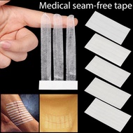 Medical Wound Closure First Aid Wound Skin Closure Surgical Tape Adhesive Sterile Wound Dressing Pos
