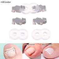 rt 1/2 Set Ingrown Toenail Corrector Tools Pedicure Recover Embed Toenail Treatment Foot Care Correc