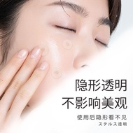 Dot Mole Waterproof Sticker Gel Scar Fade Dot Mole Sunscreen Sticker Wound Anti-Stimulate Laser Dot 