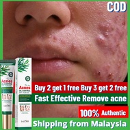 Acne cream Acne gel Face Cream ubat jerawat Krim Jerawat Muka Punggung pimple parut jerawat Penjagaa