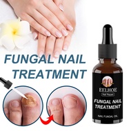 eelhoe nail fungus treatment liquid Nail repair liquid
