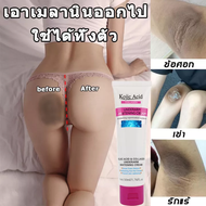 Kojic Acid Armpit Whitening Cream:ครีมทาขาหนีบดำ คอดำ ครีมทารักแร้ดำ 50ML ลดเมลานิน ปรับผิวหมองคล้ำ 