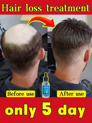 No longer worry about baldness, you will grow thick hair by using this product