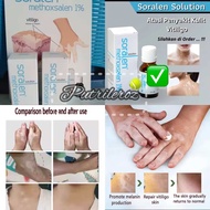 Obat Vitiligo Soralen / ampuh mengatasi belang putih dikulit pigmen kulit berlebihan