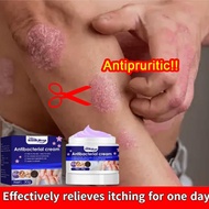 Eczema Treatment Antibacterial Cream Eczema Itching Dermatitis Herpes Skin Healing Cream Psoriasis C