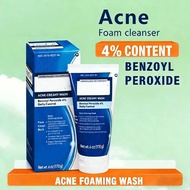 acne creamy wash 170g with benzoyl peroxide anti-acne oil control gentle cleanser