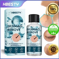 HBESTY Skin Tag Remover 30ml – Herbal Essence Removes Horn Spots, Skin tags, and Warts.| CHEAP PRICE