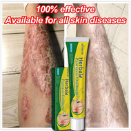 iHOMEn�Psoriasis Cream Skin itching dampness toxicity antibacterial cream ubat gatal gatal kulit ant