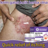 Eczema cream krim gatal antifungal cream psoriasis cream 30g Herbal antibacterial cream eczema relie