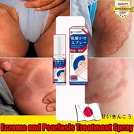 Eczema anti itch cream Japan itchy skin psoriasis cream antifungal cream Herbal formula Repairs skin