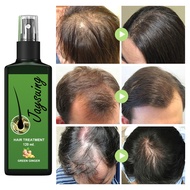 Jaysuing Ginger Hair Growth Spray Hair Tonic Growth Anti Hair Loss Treatment Hair Growth Serum