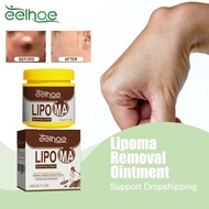 Lipoma Removal Ointment Anti-Tumor Treat Skin Cyst Swelling Pain Nodular Discomfort Treatment Lipoly