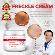 pekas remover cream original melasma remover from japan melasma and pekas remover japanese melasma c