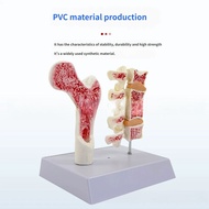 Human Bone Structure Comparison Model Femur Spine Lumbar Bone Anatomy Learning Tool