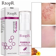 ORIGINAL RtopR Pencerah Wajah Propolis Repair Acne Brightening Serum Acne Scar Spots Cleaning Serum