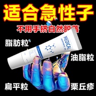 ✨Official Remove Fat Granules Eye Cream Sweat Tube Granules Remover Heavy Remove Fat Granules Around