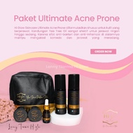 Hi Glow Skincare Ultimate Acne Prone Series Original, Acne And Scar Removal Is BPOM