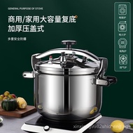 Stainless Steel Explosion-Proof Multi-Function Pressure Cooker Commercial Hotel Extra Large Capacity