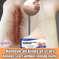 Silicone Scar Sheet plester silikon penghilang keloid bekas luka Silicon Keloid Plester Bekas Luka S
