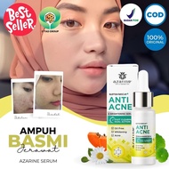 Azarine Acne Scar Removal Serum Acne Serum Package To Remove Acne Scars Serum Blackhead Azarine Acne