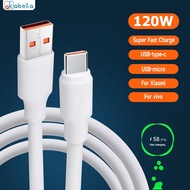 AKABEILA สายชาร์จ Type C ชาร์จเร็ว 120W สายชาร์จข้อมูล USB-C สายชาร์จ USB For  Samsung Xiaomi OPPO V