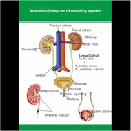 Hospital Human Body Urinary System Structure Schematic Diagram Poster Urinary System Structure Stone