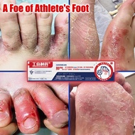 Anti Fungal Foot Cream 20g Foot fungus Fungal infection foot Athlete's Foot-Foot Odor Remover Foot A