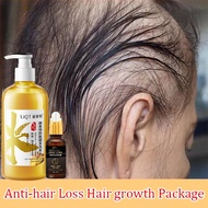 Hair loss shampoo Hair growth shampoo Anti hair loss Ginger shampoo 500MLStrengthen hair roots Hair growth Ginger and Ginseng Herbal Extract Anti hair loss