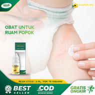 Obat Ruam Popok Selangkangan Merah Pada Bayi Iritasi Pada Kulit Bayi Pantat Bayi Lecet Biang Keringa