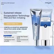 20% Azelaic Acid Acne-Removal Cream for Reducing Acne Scars