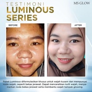 MS GLOW LUMINOUS SERIES Paket Lengkap Luminous Ms Glow Luminous Ms Glow 1 Paket Lengkap Paket Lumino