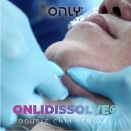 ONLY Aesthetics ONLiDissolve Non-Surgical Double Chin Removal Treatment Trial