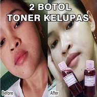 COD..2 BOTOL TONER KELUPAS||TONER FLEK||TONER WHITENING