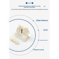 Transparent Dental Implant Model Dental Restoration Model Transparent Removable Pathological Implant