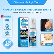 Ximonth Psoriasis Herbal Treatment Spray 30ml Eczema Psoriasis Spray Relief From Itching Repairs Ecz