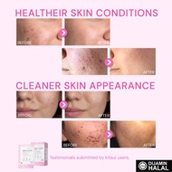 KITSUI Whitie Snow | 17's x 15g  - Minuman Beri Probiotik + Niacinamide Menyokong Kesihatan Kulit & 