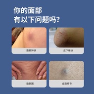 Today New Products/Japan Iran Rise Fat Kangpi Lower Knots Swelling Blocks Fat Kang Cream Bump Hard B