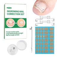 [tutuout] 1/2 Set Ingrown Toenail Corrector Tools Pedicure Recover Embed Toenail Treatment Professio