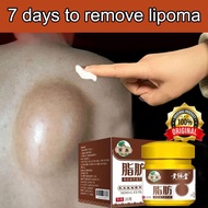 lipoma cream lipoma removal cream benjolan ubat benjolan Removal Multiple Single Lipoma Subcutaneous