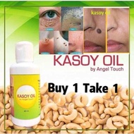( Buy 1 Take 1 ) FREE Warts Remover; can also remove Dandruff, Kalyo etc. MIRACLE Kasoy Oil (60ml)
