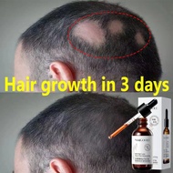 serum rambut gugur Minyak Lebatkan Rambut Rosemary oil air Tonic Hair Growth Serum Hair tonic 60ml P