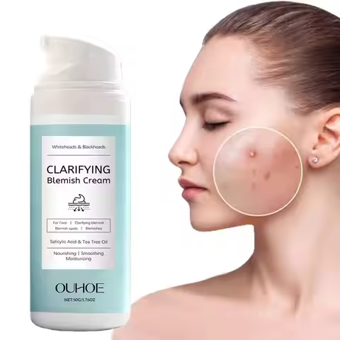 Salicylic Acid Acne Removing Cream Nourishing Lightweight Non Greasy Salicylic Acid Blemish Cream fo