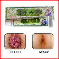 Hemorrhoids Ointment Vietnam Hemorrhoids Cream Painkiller Pain Relief External Anal Fissure Medical 