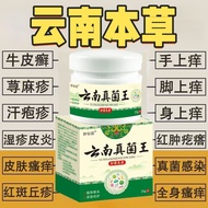 Itchy Skin Relief Cream Fast Itch Relief Dry Itchy Skin External Use Whole Body Dry Itch Yunnan Fung