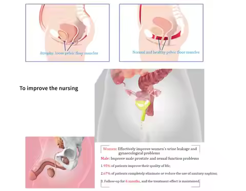 Hot Sales Salon Beauty Ems Sculpting Pelvic Floor Machine Pelvic Floor Chair Ems Urinary Incontinenc
