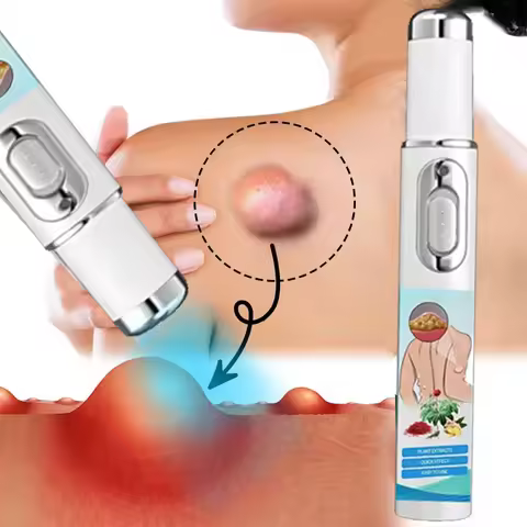 Laser Lipoma Pointer Lipoma Removal Laser Pointer Efficiently Removes Lipoma Fibroids Subcutaneous L