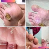 DVELINIL mole, wart and skin tag removal solution 3ml